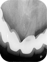 Radiografía inicial